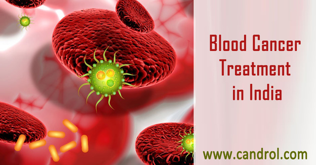 Blood Cancer Treatment in India Picture Box