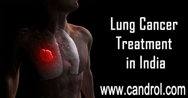 Lung Cancer Treatment in India Picture Box