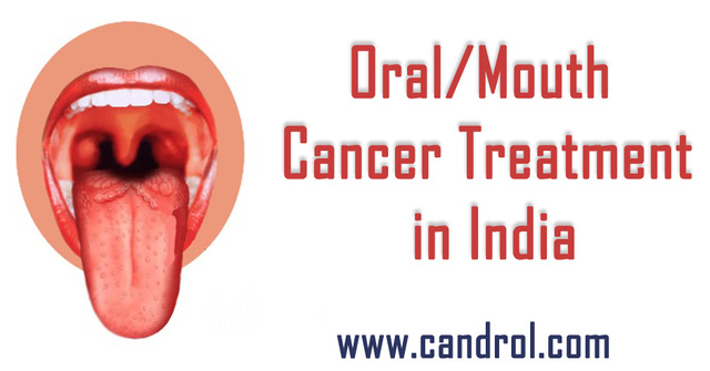 Oral/Mouth Cancer Treatment in India Picture Box