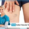 Laser Varicose Veins Treatm... - Indian vascular surgery