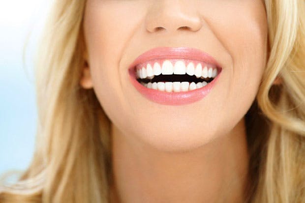 iStock 36589000 LARGE Wider Smiles : Gives You Wider Smile With White Teeth