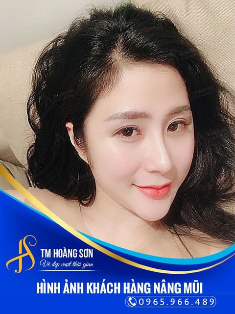 há»©a hiá»ƒu loan kh 2019 Tháº©m Má»¹ Viá»‡n BÃ¡c SÄ© HoÃ ng SÆ¡n