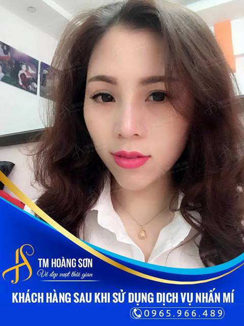 nguyễn phương ly  Kh 2019 Thẩm Mỹ Viện Bác Sĩ Hoàng Sơn