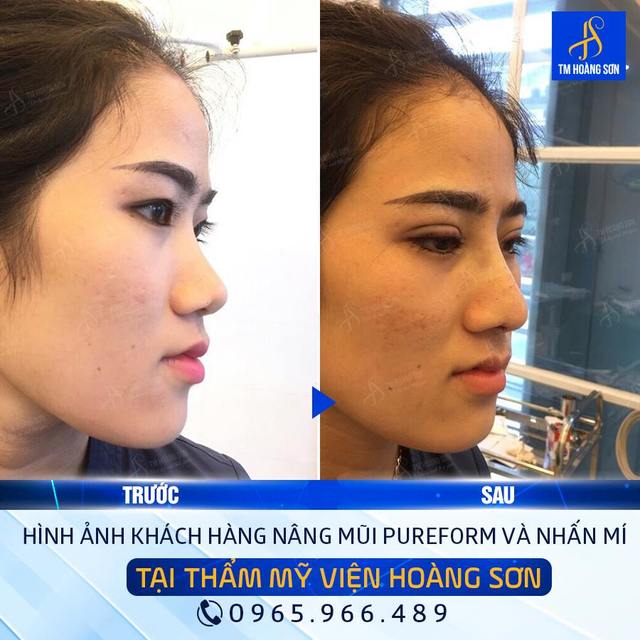 Kh chÆ°Æ¡ng má»¹ Tháº©m Má»¹ Viá»‡n BÃ¡c SÄ© HoÃ ng SÆ¡n