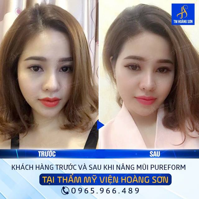 Kh lÃ¢m tÃ¢m Tháº©m Má»¹ Viá»‡n BÃ¡c SÄ© HoÃ ng SÆ¡n