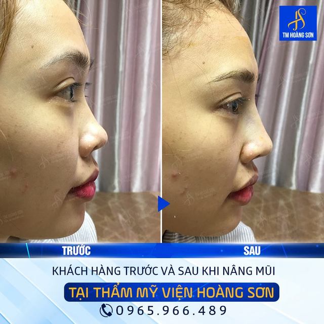 Kh trÆ°Æ¡ng lÃ½ Tháº©m Má»¹ Viá»‡n BÃ¡c SÄ© HoÃ ng SÆ¡n