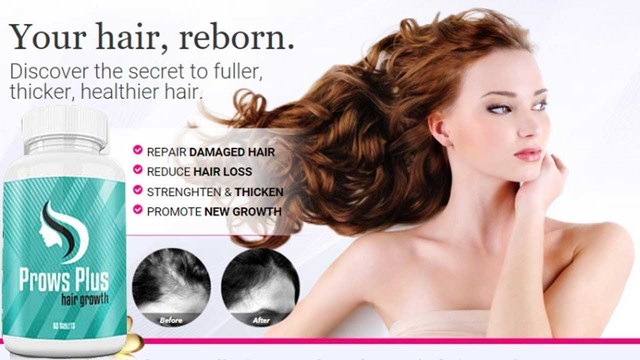 Just what is Prows Plus Hair Growth? Prows Plus