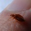 Can-you-see-bed-bugs-with-t... - The effective cure for bed bugs- Seek Professional Help