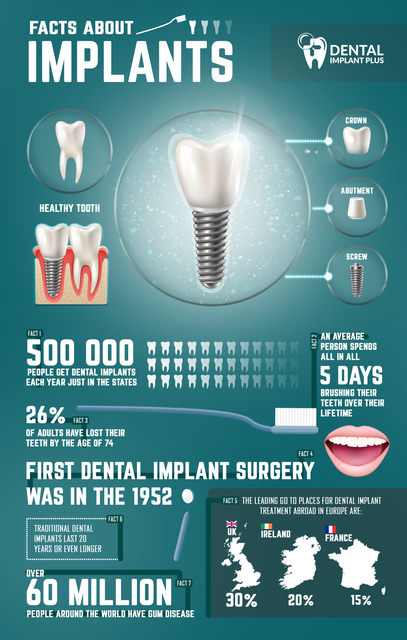 7 facts about dental implants Picture Box