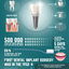 7 facts about dental implants - Picture Box
