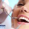Teeth Whitening Treatment B... - Picture Box