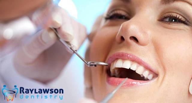 Teeth Whitening Treatment Brampton Picture Box