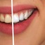 Cosmetic-Dentistry-Spa - Cosmetic Dentistry Coral Gables