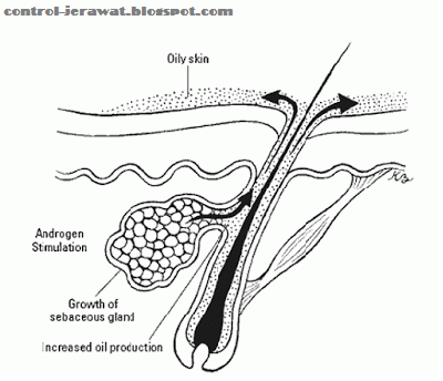 androgen Picture Box