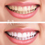 500 F 46467358 P3uMHPSMbhWv... - Teeth Whitening Dentist