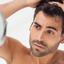 Male-Hair-Loss - Picture Box