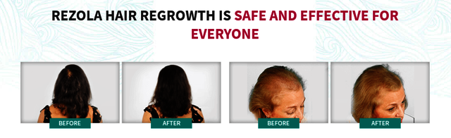 Rezola Hair Growth Pills Australia Price Where to  Rezola growth