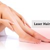 Laser hair removal service