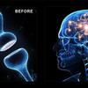 imaggh - How Does Work GenBrain Pills