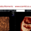 a baby scan