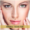 wrinkle-treatment - Jbcosmetic