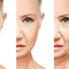 Botox Treatment at Affordab... - Jbcosmetic