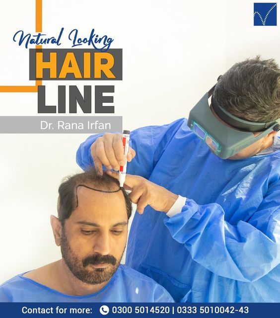 118843860 380302653360327 5507592317369035933 o Vagus Hair Transplant | Dr Rana Irfan