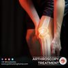 Arthroscopy treatment - JYOTI NURSING HOME