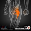 hip replacement - JYOTI NURSING HOME