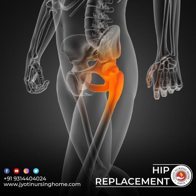 hip replacement JYOTI NURSING HOME