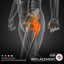 hip replacement - JYOTI NURSING HOME