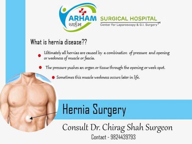 Hernia-Doctor-Hospital-Ahmedabad-Gujarat Dr. Chirag J Shah - Hernia Doctor Near Me | Hernia Surgeon in Ahmedabad