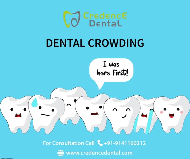 Dental Crowding -Why is it important to rectify th Picture Box