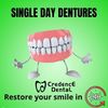 Single-Day Dentures â€“ Tra... - Picture Box