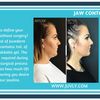 Jaw Contouring