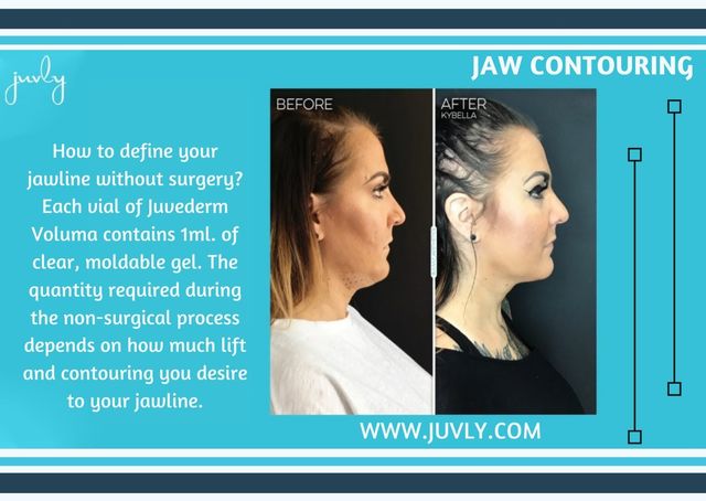 5. Jaw Contouring Jaw Contouring