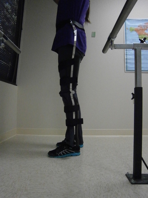 prosthetic doctor near me Green Bay WI Orthotics and Prosthetics in Green Bay, WI