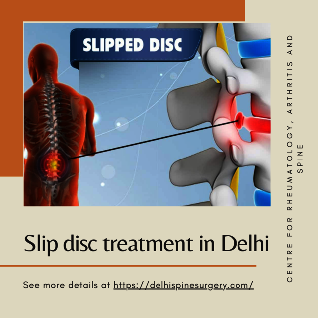 Slip disc treatment in Delhi Picture Box