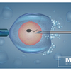Sperm donation - Fertility Clinic in Limasso...