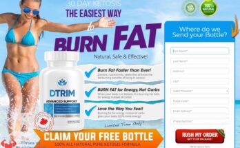 DTrim Advanced Support Picture Box