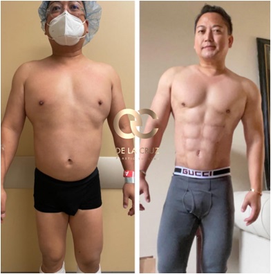 Best Plastic Surgeons In Texas Best Plastic Surgeons In Texas