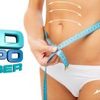 3D-LIPO-LASER3-214x131 - Toronto Weight Loss and Wel...
