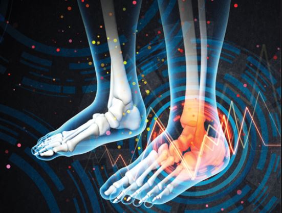 Peripheral Neuropathy Treatment Near Me PainlessCare80