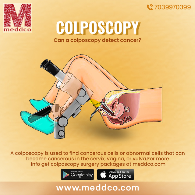 colposcopy 1 Colposcopy - Meddco