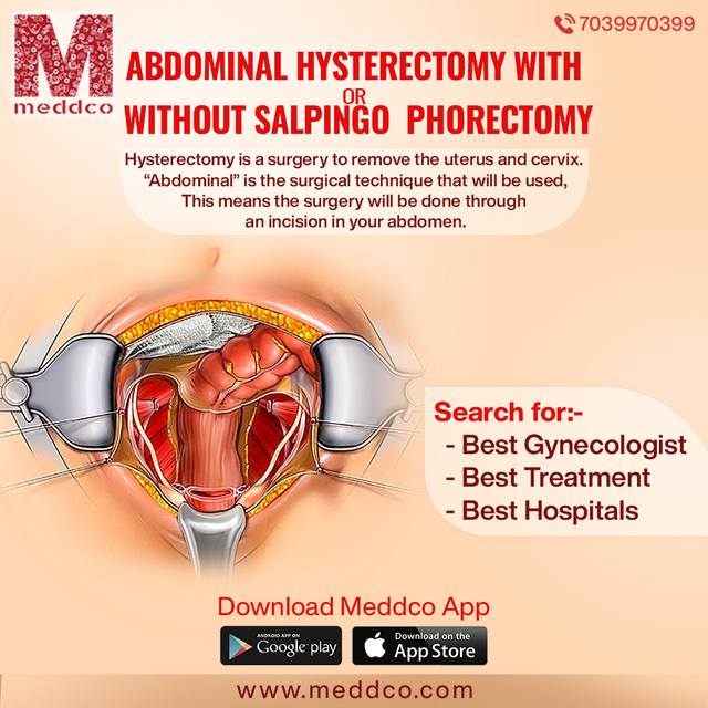 Abdominal Hysterectomy with or salpingo phorectomy Picture Box