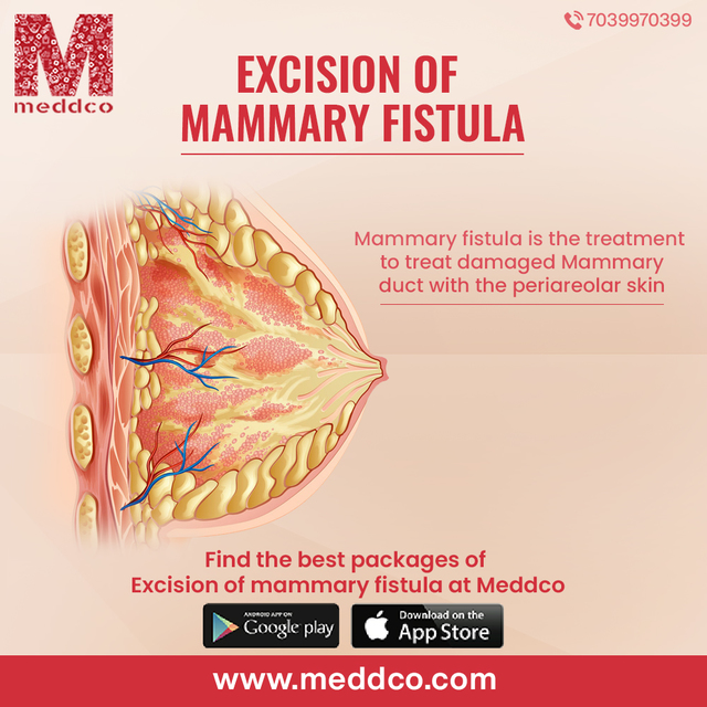 Excision of mammary fistula 1 Excision of mammary fistula - Meddco