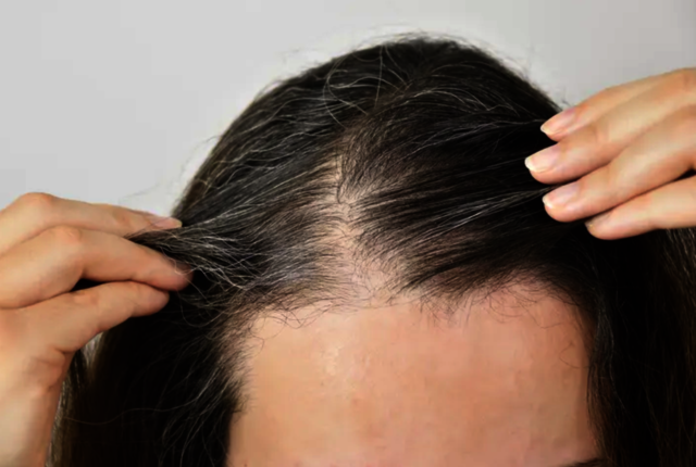 Follicle Fix Hair Regrowth Formula Follicle Fix Hair Regrowth