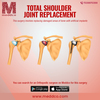 Total Shoulder Joint Replac... - Picture Box