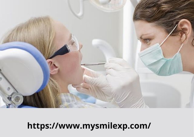 Cracked Teeth Treatment- My Smile Experience Picture Box