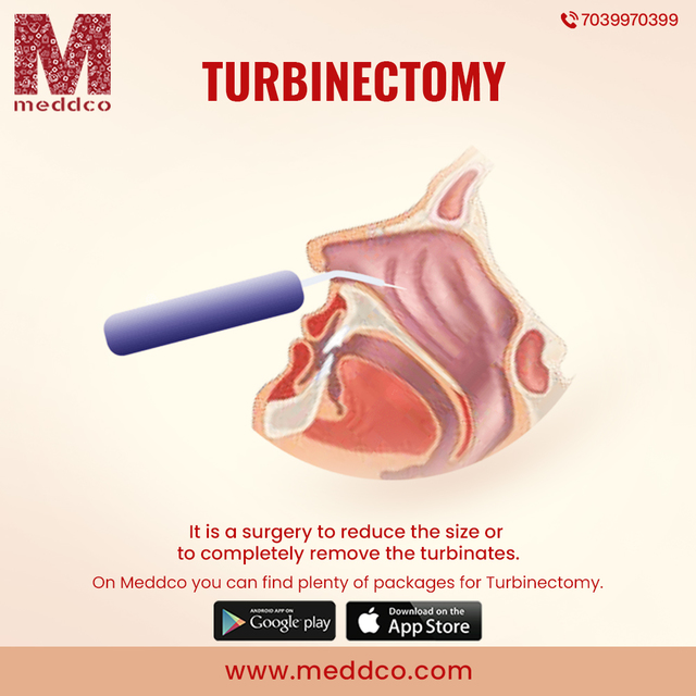 turbinectomy - Meddco Picture Box